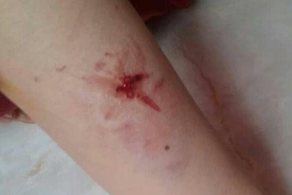 حمله سگ به یک خانم در لواسان