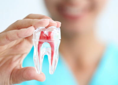 اطلاعات جامع در خصوص ایمپلنت دندان